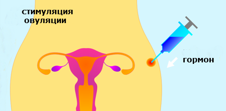 Фото:Как происходит стимуляция яичников?